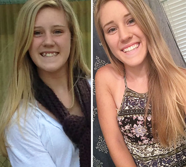 It's crazy what less than 2 years with braces will do. Thank you, mom and dad,