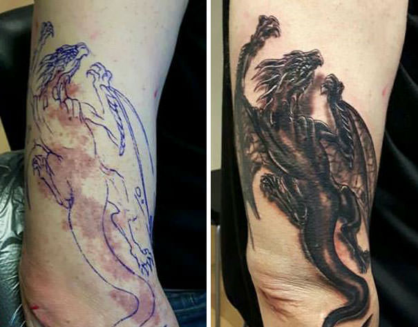 Crawling dragon tattooed over a birthmark
