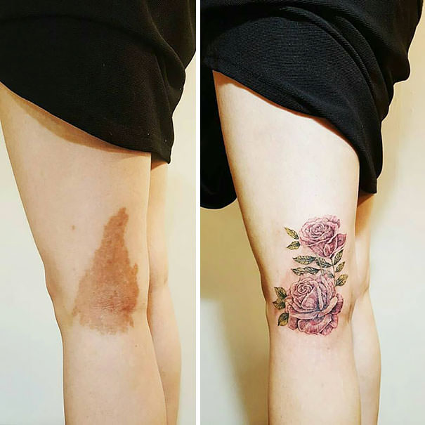 Birthmark coverup tattoo