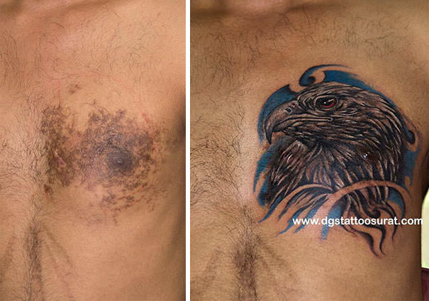 Eagle tattoo covering a birthmark