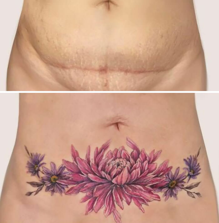 C-section tattoo cover-up