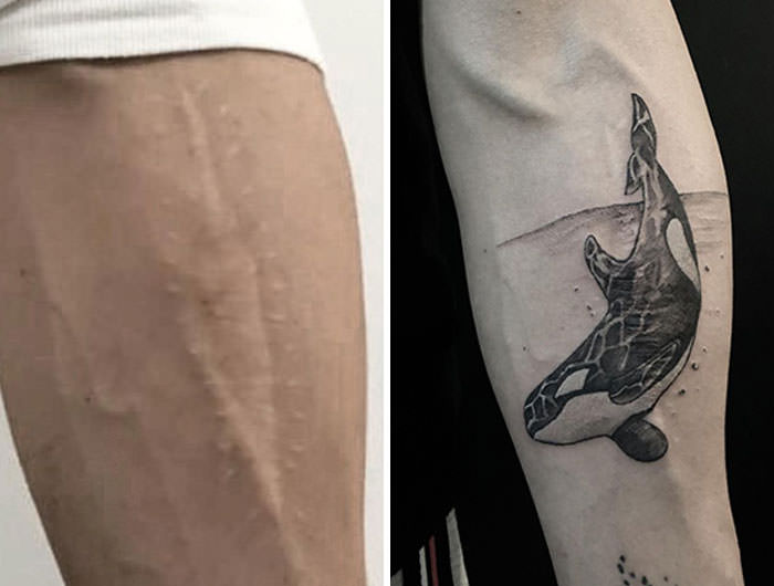 Scar tattoo cover-up