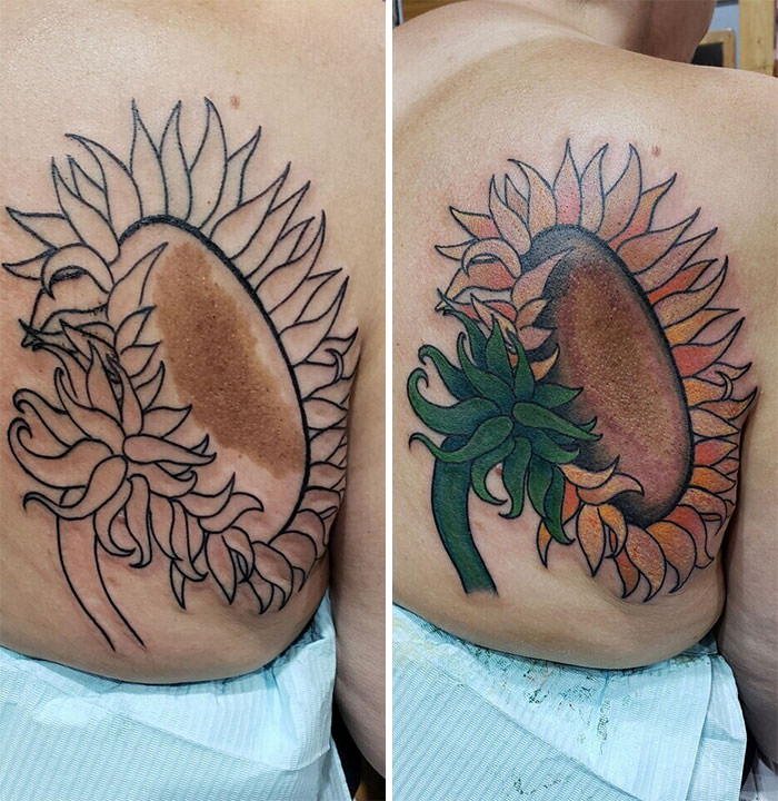 Birthmark into this bold sunflower tattoo