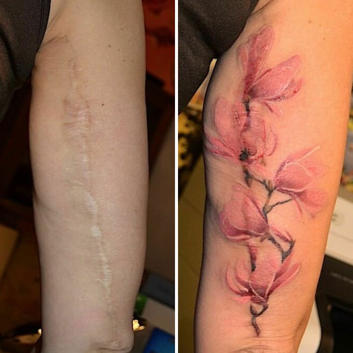 Scar tattoo cover-up