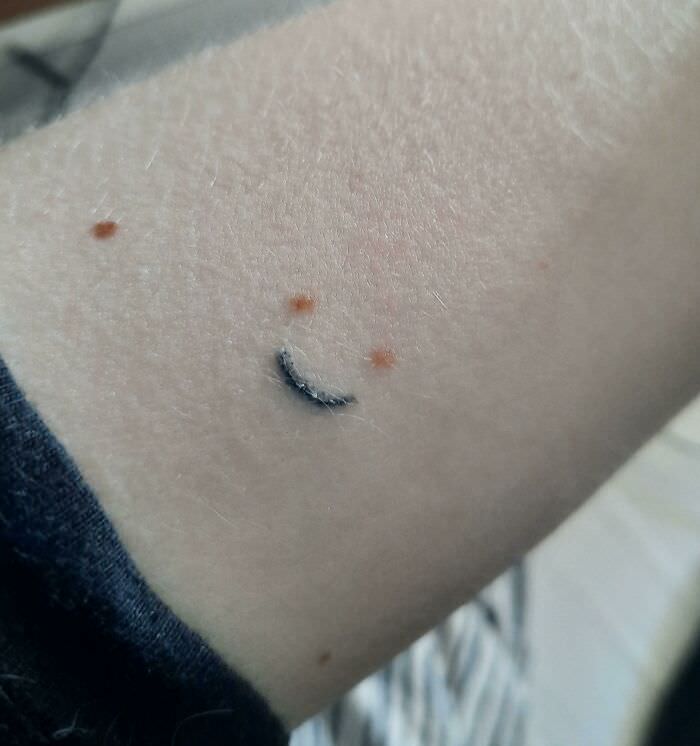 Lil smiley tattoo i've made out of birthmarks 2 days ago