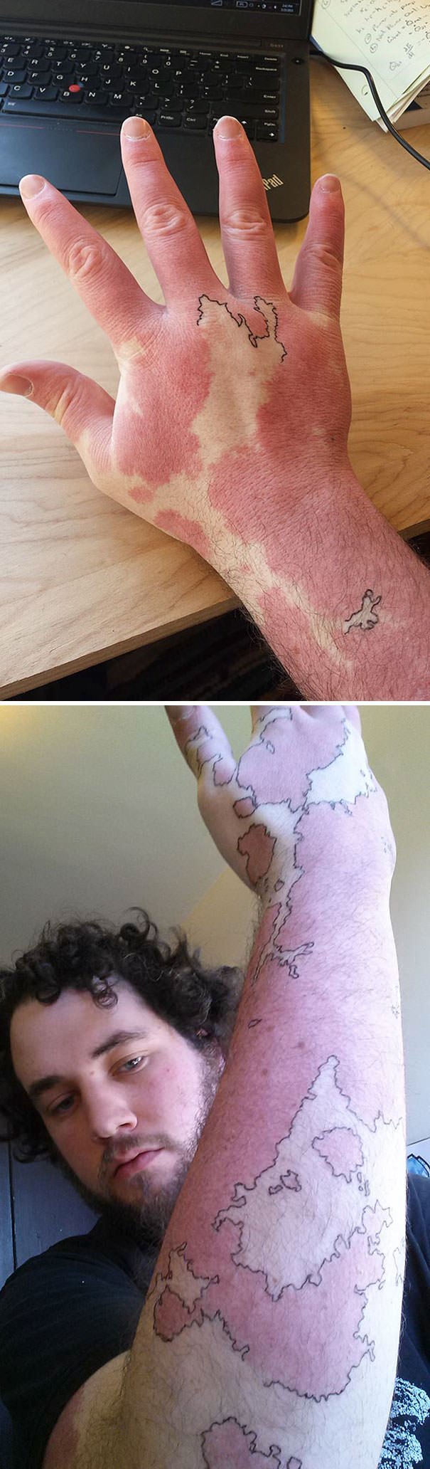 Guy transformed his birthmark into a map of an imaginary world by drawing around it with a pen