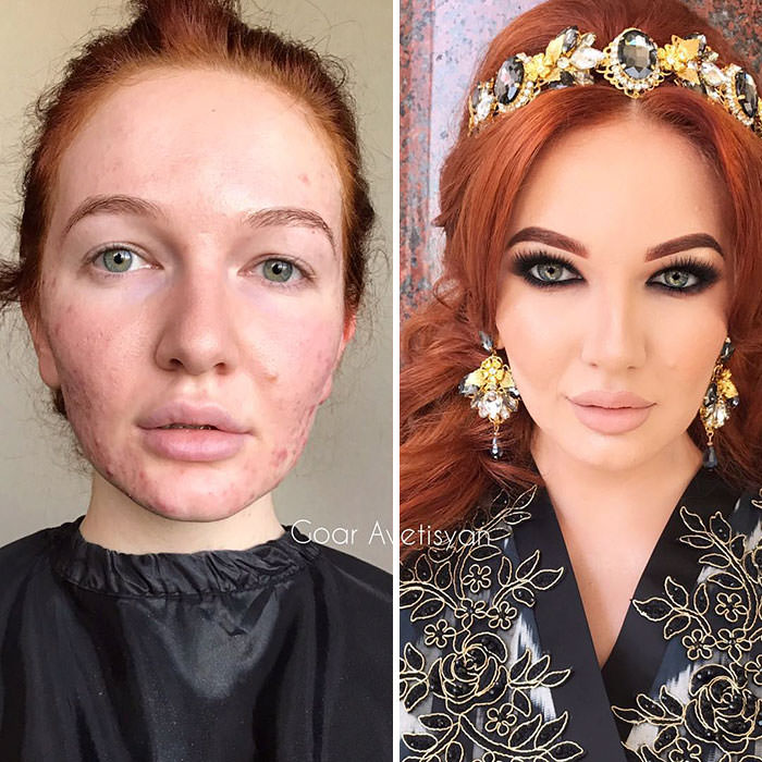 Harem look on a model with acne-prone skin