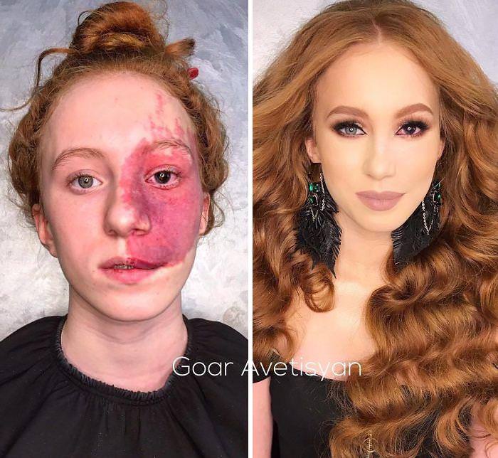 Incredible Scar Covering Makeup Transformations that Are Absolutely Beautiful