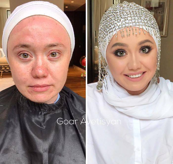 Incredible Scar Covering Makeup Transformations that Are Absolutely Beautiful