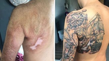 Birthmark Coverup Tattoos