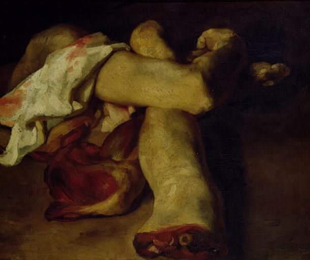 Anatomical Pieces by Theodore Gericault
