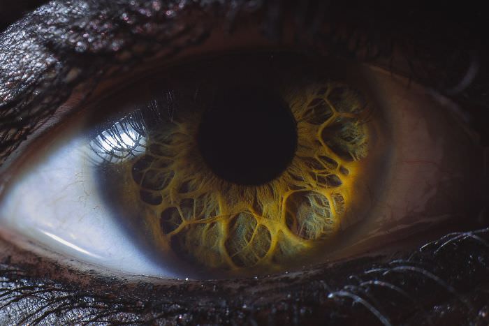 A picture of a unique eye.