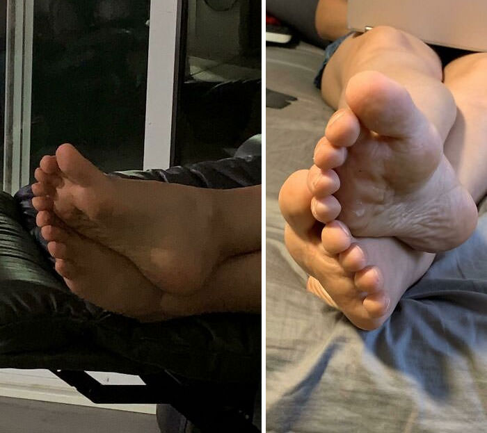 Perfect alignment of fiancé's toes