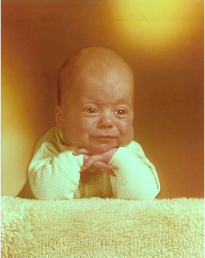 My husband as an infant. I prayed our children would not inherit his large cranium.