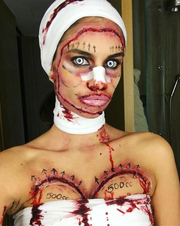 Sara Sampaio as plastic surgery.