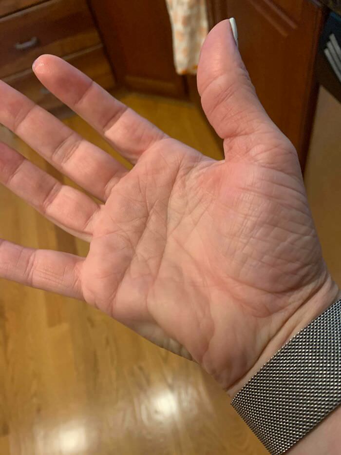 I got a cramp in the side of my hand, and you can actually see it.