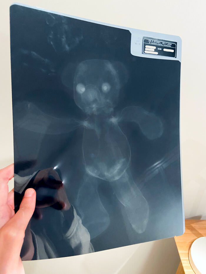 X-ray of my childhood bear, taken in the 90s.