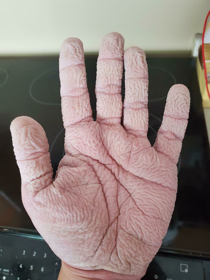 My hands after washing the dishes for 20 minutes.