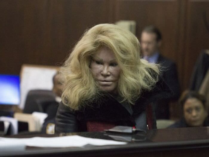 This is Jocelyn Wildenstein, the wealthy socialite nicknamed "Bride of Wildenstein" and "Catwoman" because of her extreme plastic surgery.