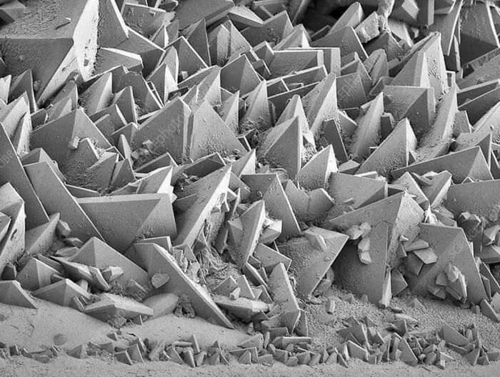 Kidney stones under an electron microscope.
